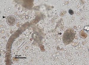 Bc_cyst_troph_B trophozoite