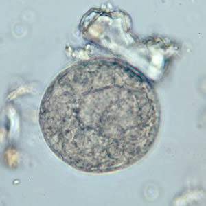 Bcoli_cyst_wtmt3.jpg