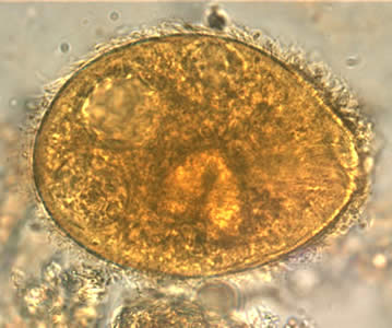 Bcoli_troph_wtmt2_OR.jpg