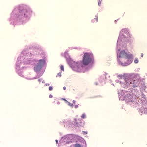 Bcoli_troph_hande2_colon.jpg