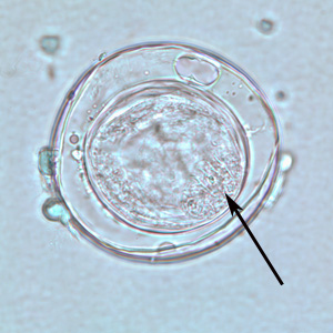 Bertiella_egg_BAM_1000x2.jpg