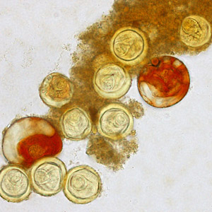 Bertiella_egg_Clinipath_A.jpg