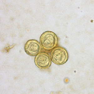 Bertiella_egg_Clinipath_B.jpg