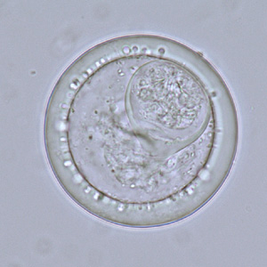 Bertiella_eggs_LTU2.jpg