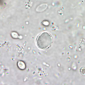 Bhominis_cyst_wtmt2.jpg Figure B