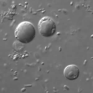 Bhominis_cyst_DIC.jpg Figure A