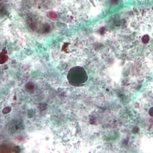 Bhominis_cyst_tric4.jpg Figure D