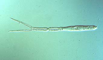 CercarialDermatitisA.jpg Figure A