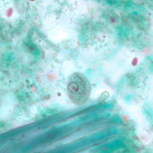 C_mesnili_cyst_trichrome_BM2.jpg