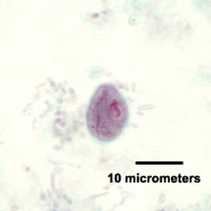 C_mesnili_cyst_trichrome_HB1.jpg