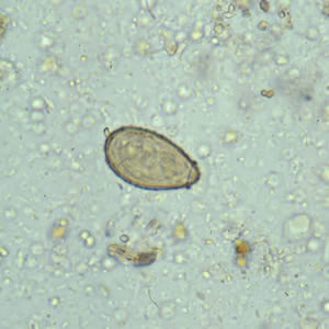 Clonorchis_egg.jpg