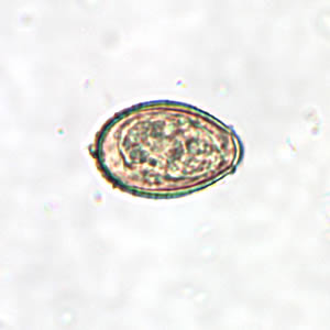 Clonorchis_egg2.jpg