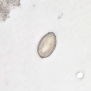 Clonorchis_egg5_web.jpg