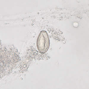 Clonorchis_egg6_web.jpg
