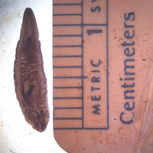 Clonorchis_adult_web.jpg