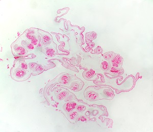 tissue_coen_A
