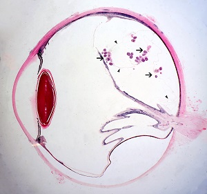 eye_A