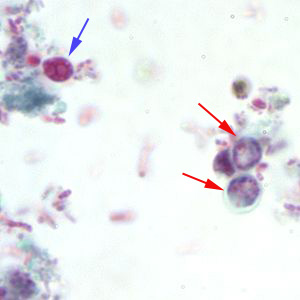 Cparvum_trichrome1_BAM.jpg