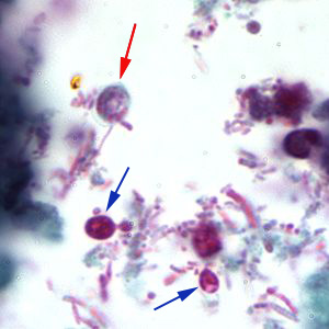 Cparvum_trichrome2_BAM.jpg