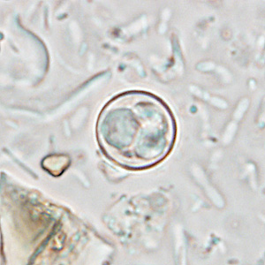 Cyclospora_wetmount_HB1.jpg