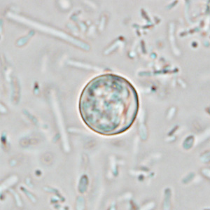 Cyclospora_wetmount_HB2.jpg