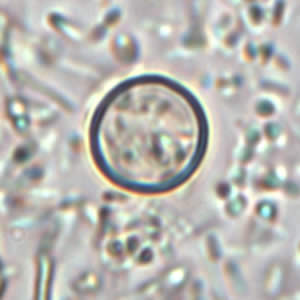 Cyclospora_wtmt_1000X_OR.jpg