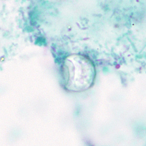 Cyclospora_trichrome_HB1.jpg