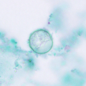 Cyclospora_trichrome_HB2.jpg