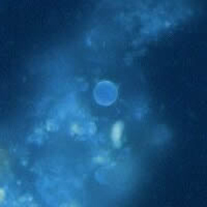 Cyclospora_UV_Henry1.jpg