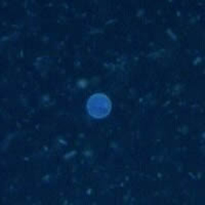 Cyclospora_UV_Henry2.jpg
