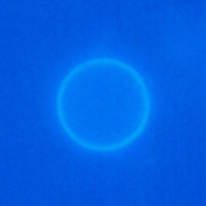 Cyclospora_UV_Mike1.jpg