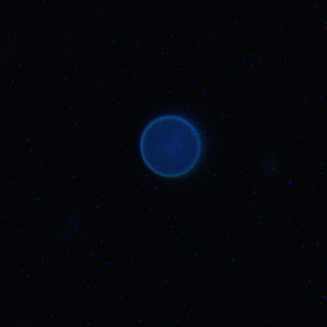 Cyclospora_UV_Mike2.jpg