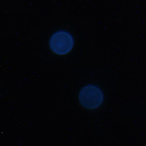 Cyclospora_UV_Mike3.jpg