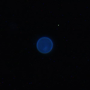 Cyclospora_UV_Mike4.jpg