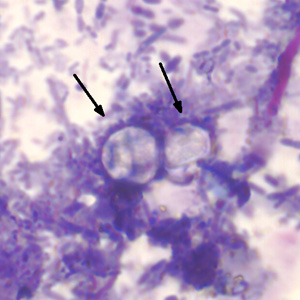 Cyclospora_AF_AZ1.jpg