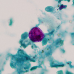 Cyclospora_AF_Henry2.jpg