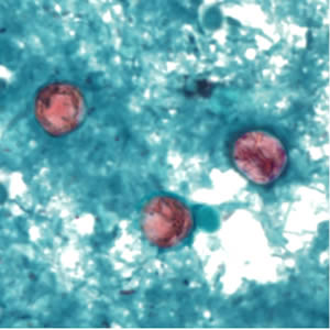 Cyclospora_SAF_Henry3.jpg