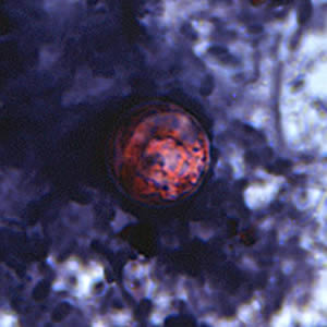 Cyclospora_SAF_Henry4.jpg