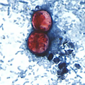 Cyclospora_SAF_Henry5.jpg