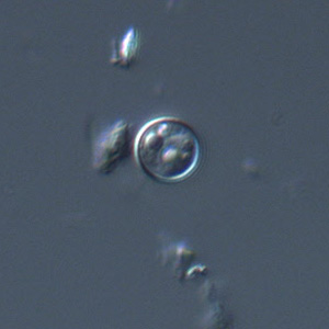 Cyclospora_DIC_Mike1.jpg