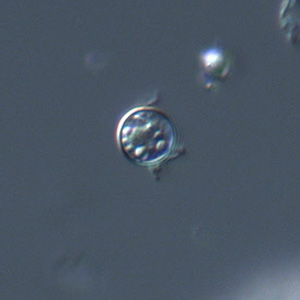 Cyclospora_DIC_Mike2.jpg