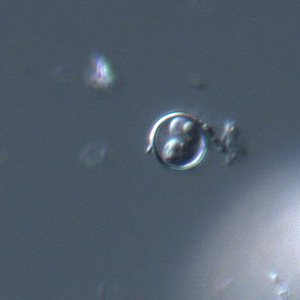 Cyclospora_DIC_Mike3.jpg
