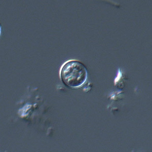 Cyclospora_DIC_Mike5.jpg
