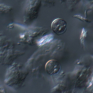 Cyclospora_DIC_Mike6.jpg