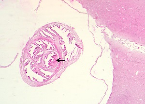 Cysticercus_B Figure B