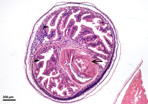 Cysticercus_C