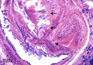 Cysticercus_D Figure D