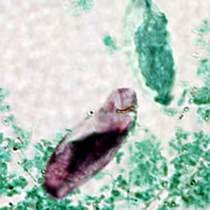 C_belli_oocyst_acidfast.jpg