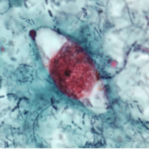 C_belli_oocyst_safranin.jpg