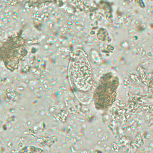 C_belli_spore_wtmt1.jpg